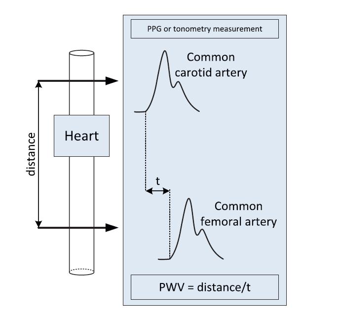 Graphical representation illustrating the Pulse Wave Velocity (PWV) measuring technique.