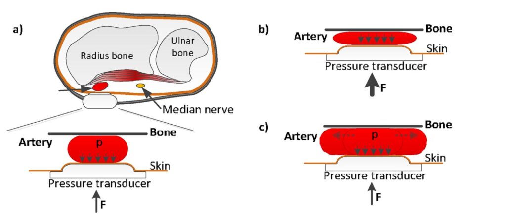 Diagram demonstrating the methodology of the tonometry technique for measuring intraocular pressure.