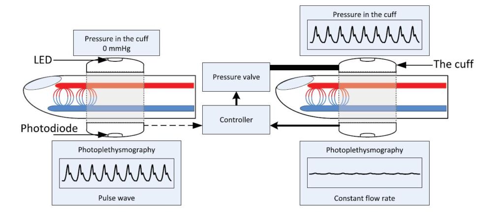 Diagram showcasing the methodology of the volume clamp technique for non-invasive arterial blood pressure measurement.