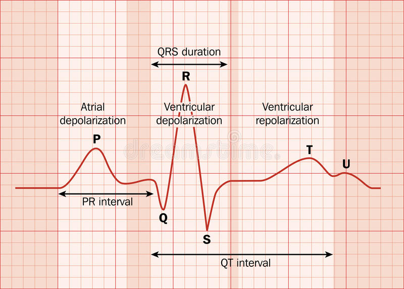 Graphical representation of a typical electrocardiogram waveform showing P wave, QRS complex, and T wave, depicting the electrical activity of a heartbeat.