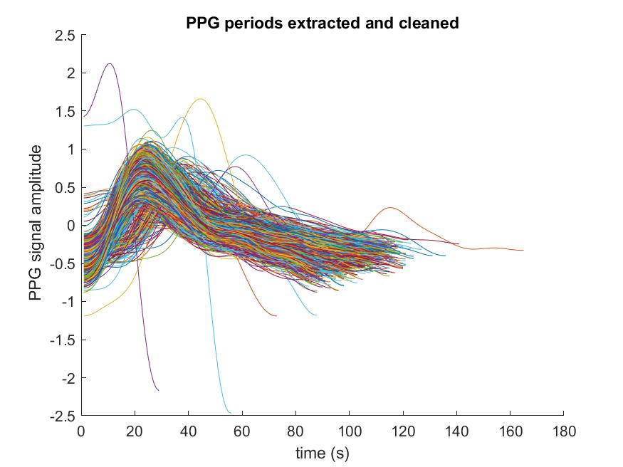 Corrected PPG Periods Segmentation Plot for a Patient